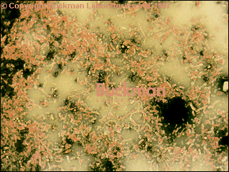 Photo of Slime bacteria