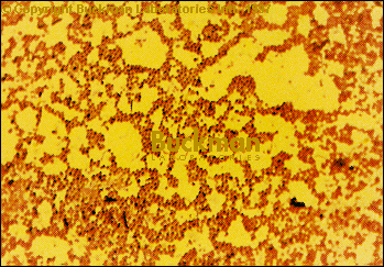 Photo of Staph bacteria